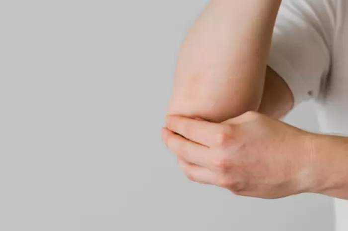 Cara Mengatasi Dark Elbows: Tips Efektif untuk Kulit Siku yang Cerah